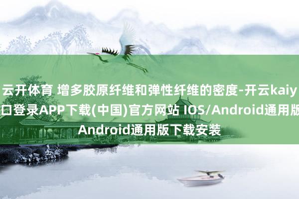 云开体育 增多胶原纤维和弹性纤维的密度-开云kaiyun登录入口登录APP下载(中国)官方网站 IOS/Android通用版下载安装